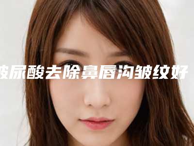 玻尿酸去除鼻唇沟皱纹好么-鼻唇沟可以填充上吗,要多少钱呢